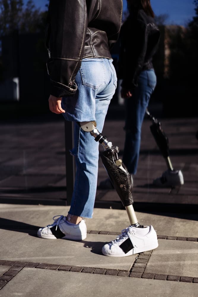 Young woman with prosthetic leg walking on university campus